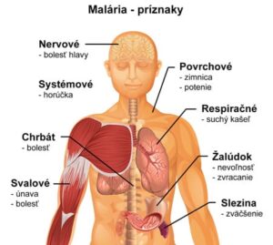 malaria-priznaky